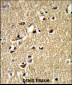 SDCCAG33 Antibody (Center)