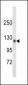 SDCCAG33 Antibody (Center)