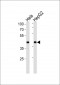 LRPAP1 Antibody (C-term)