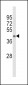 ACADL Antibody (Center)