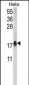 CALM1 Antibody (C-term)