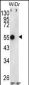 ATP5B Antibody (Center)