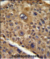 TOB1 Antibody (N-term)