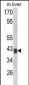 TOB1 Antibody (N-term)