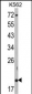 RNF5 Antibody (N-term)