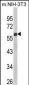 GDF10 Antibody (Center)