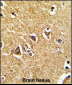 PRODH Antibody (Center)