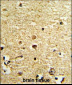 OLIG3 Antibody (Center)