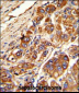KLC1 Antibody (Center)