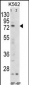 FLCN Antibody (C-term)