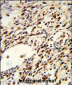 FLCN Antibody (Center)