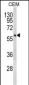 FLCN Antibody (Center)