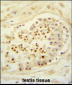 CBLB Antibody (Center)