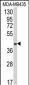 AGPAT4 Antibody (Center)