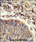 HSPA6 Antibody (C-term)