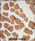 PHYH2 Antibody (C-term)