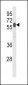 PHYH2 Antibody (C-term)