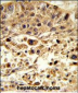 VPS26A Antibody (Center)