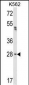 FNDC5 Antibody (C-term)