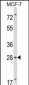 RASL11B Antibody (N-term)