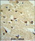 ADCY8 Antibody (Center)