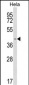 INSIG1 Antibody (N-term)