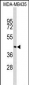 PHYH Antibody (N-term)