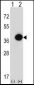 PHYH Antibody (N-term)