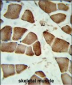 DIPA Antibody (Center)