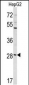 DIPA Antibody (Center)