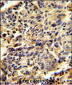 Glypican-1 Antibody (N-term)