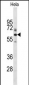 Glypican-1 Antibody (N-term)