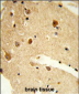 CNDP1 Antibody (C-term)