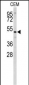 CNDP1 Antibody (C-term)