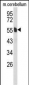 MPP6 Antibody (Center)