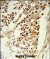 CENPH Antibody (Center)