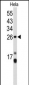 CENPH Antibody (Center)