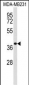 EXTL2 Antibody (C-term)