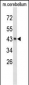 EXTL2 Antibody (C-term)