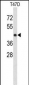 KCTD12 Antibody (Center)