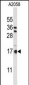 PTMS Antibody (C-term)