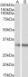 Goat Anti-Monoglyceride Lipase Antibody