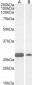 Goat Anti-PGAM1 / PGAM2 / PGAM4 Antibody