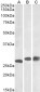 Goat Anti-PGAM1 / PGAM2 / PGAM4 Antibody