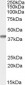 Goat Anti-SFRP2 Antibody