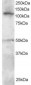 Goat Anti-SMARCA3 Antibody