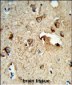 TSPAN1 Antibody (Center)