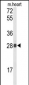 TSPAN1 Antibody (Center)