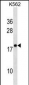 RPLP2 Antibody (N-Term)