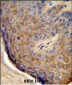 TCHP Antibody (Center)